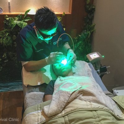 Dual Yellow Laser_Treatment