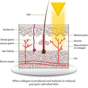 Dual-Yellow-Melasma-450x414