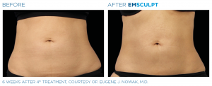 Revival Clinic|Emsculpt