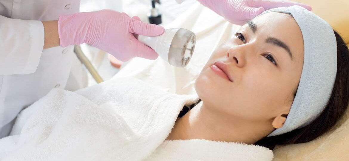 laser treatments